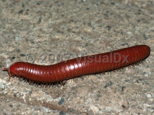 Organism image of Millipede dermatitis - imageId=3394339. Click to open in gallery.  caption: 'A millipede (<i>Arthropoda Diplopoda</i>), 8 cm long, Selva Verde, Heredia Province, Costa Rica.'