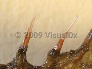 Organism image of Stonefish spine puncture - imageId=3971917. Click to open in gallery.  caption: 'The spines of a stonefish.'