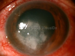 Clinical image of Pythiosis - imageId=6842169. Click to open in gallery. 